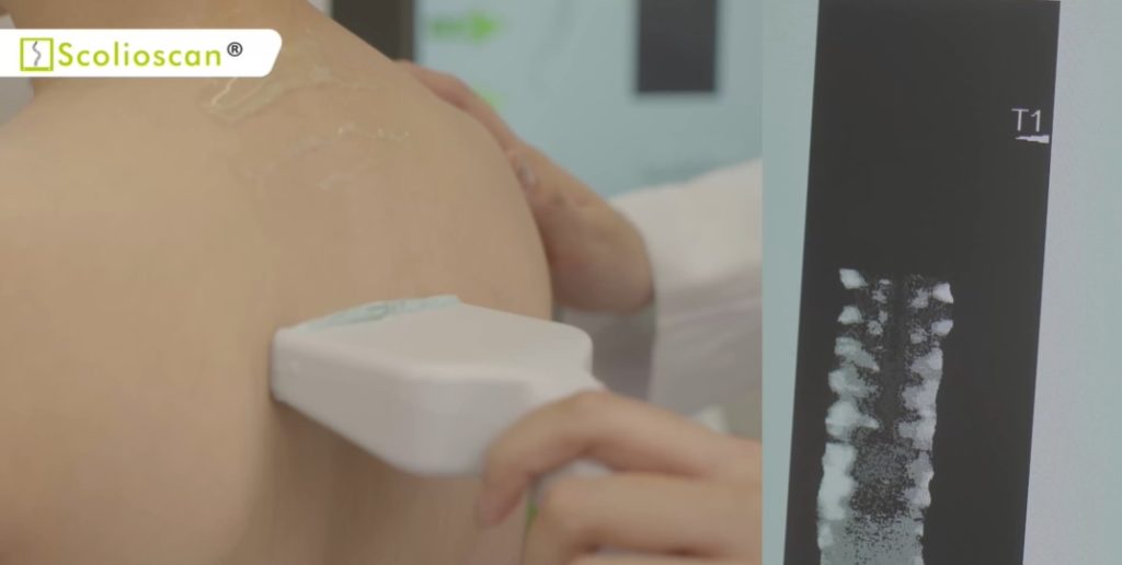 Scolioscan®