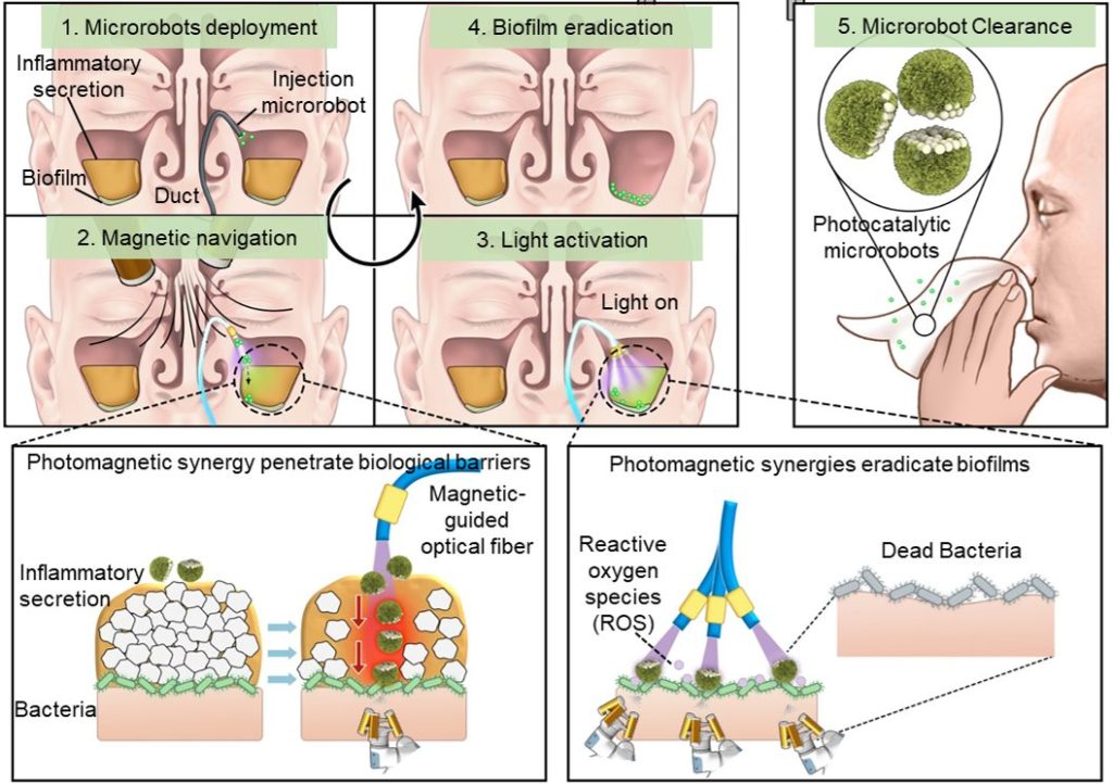 微型機械人療法
